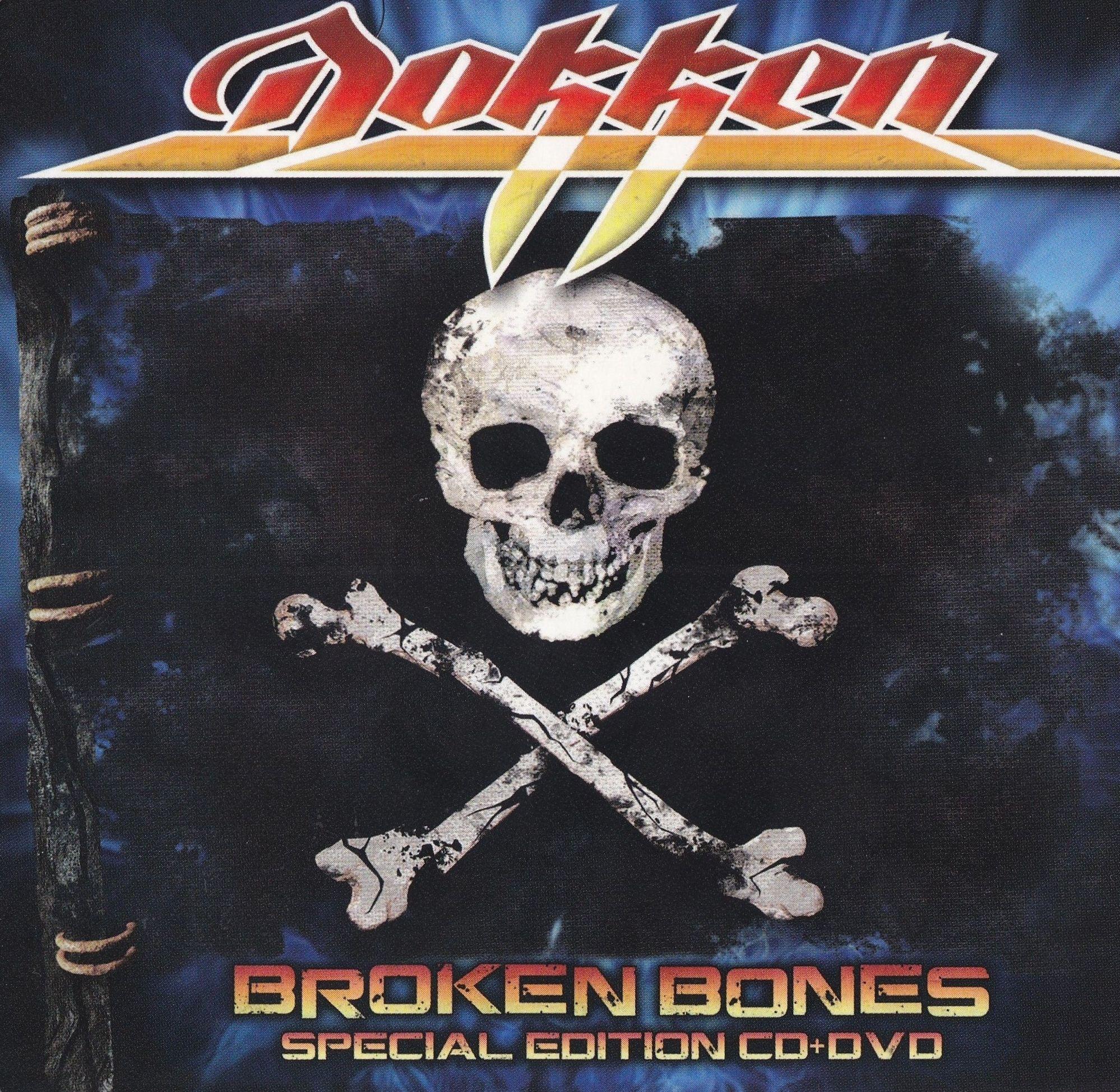 Broken Bones