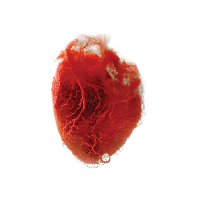 Album cover art for Love Is Simple